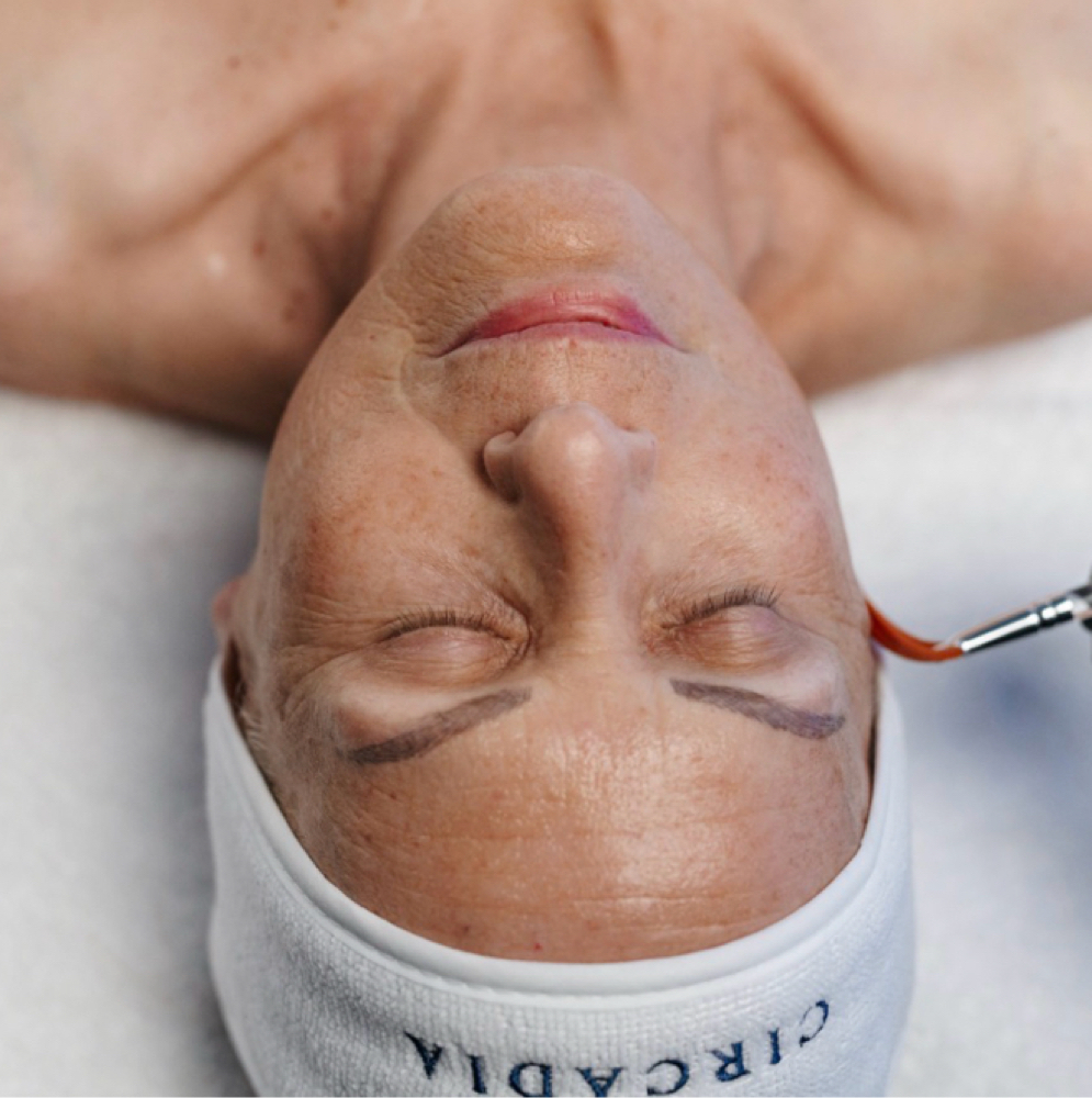 SWiCH Treatment at Luxe Artistry LLC in Warren, OH