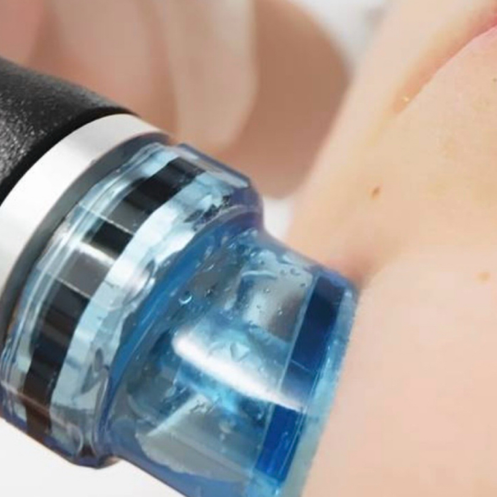 The Glassy Glow Facial at Get Glowin With Nichole in Sierra Madre, CA