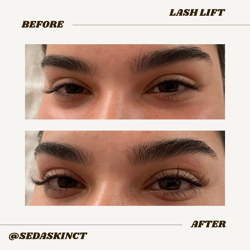 Lash Lift