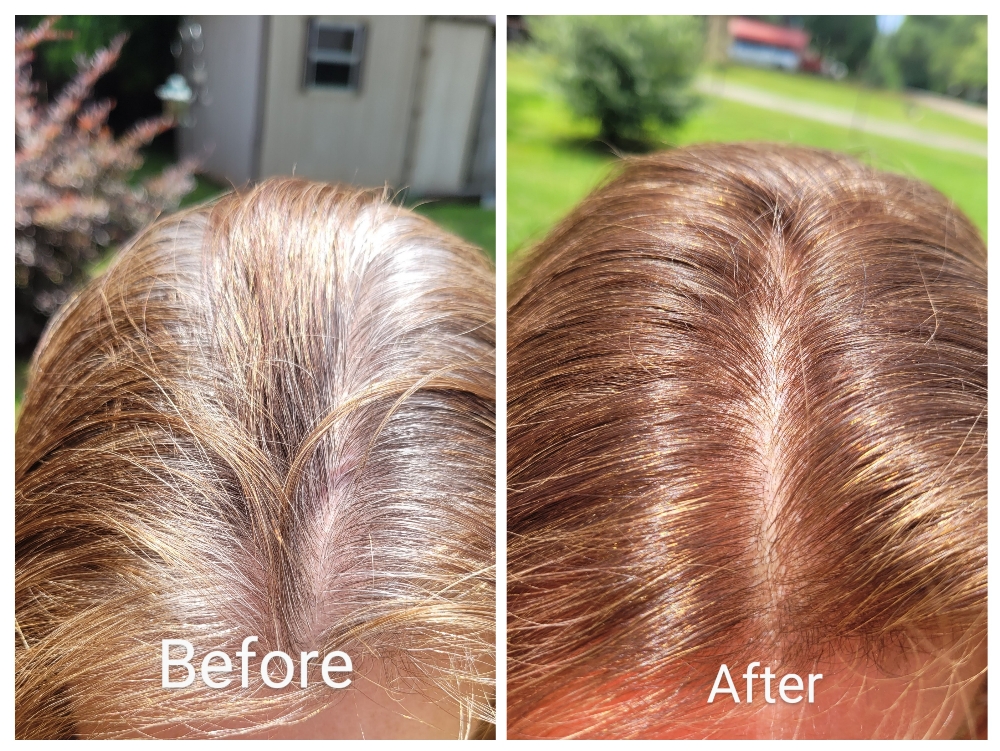 Root Retouch