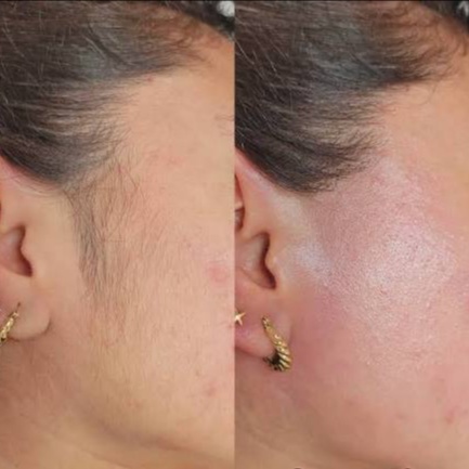 Sideburn at Honey Bee Smooth in Richmond, KY