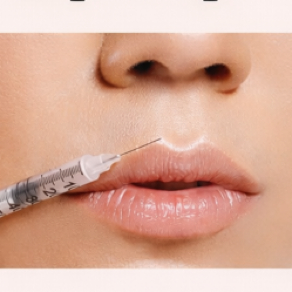 Lip Flip at Alluring Glow Aesthetics in kettering, OH