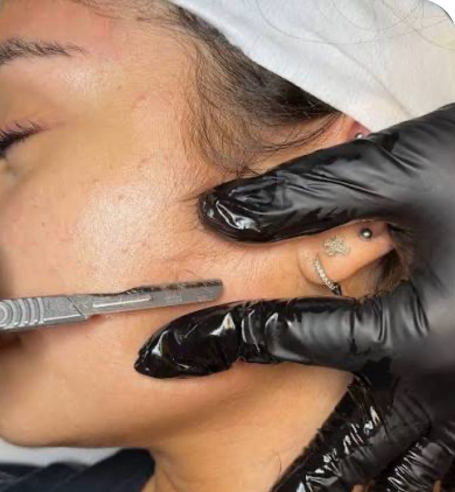Add On Dermaplane