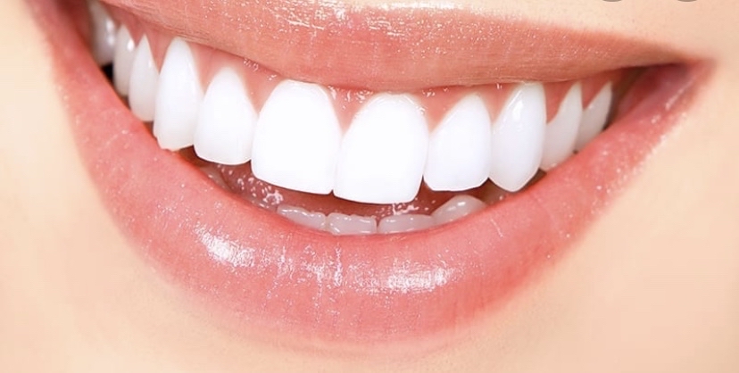 Teeth Whitening 30 Min W/ Kelly