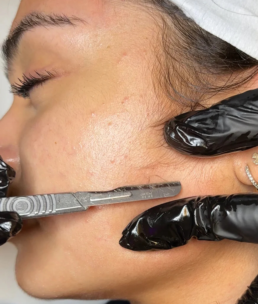 Dermaplaning Add On
