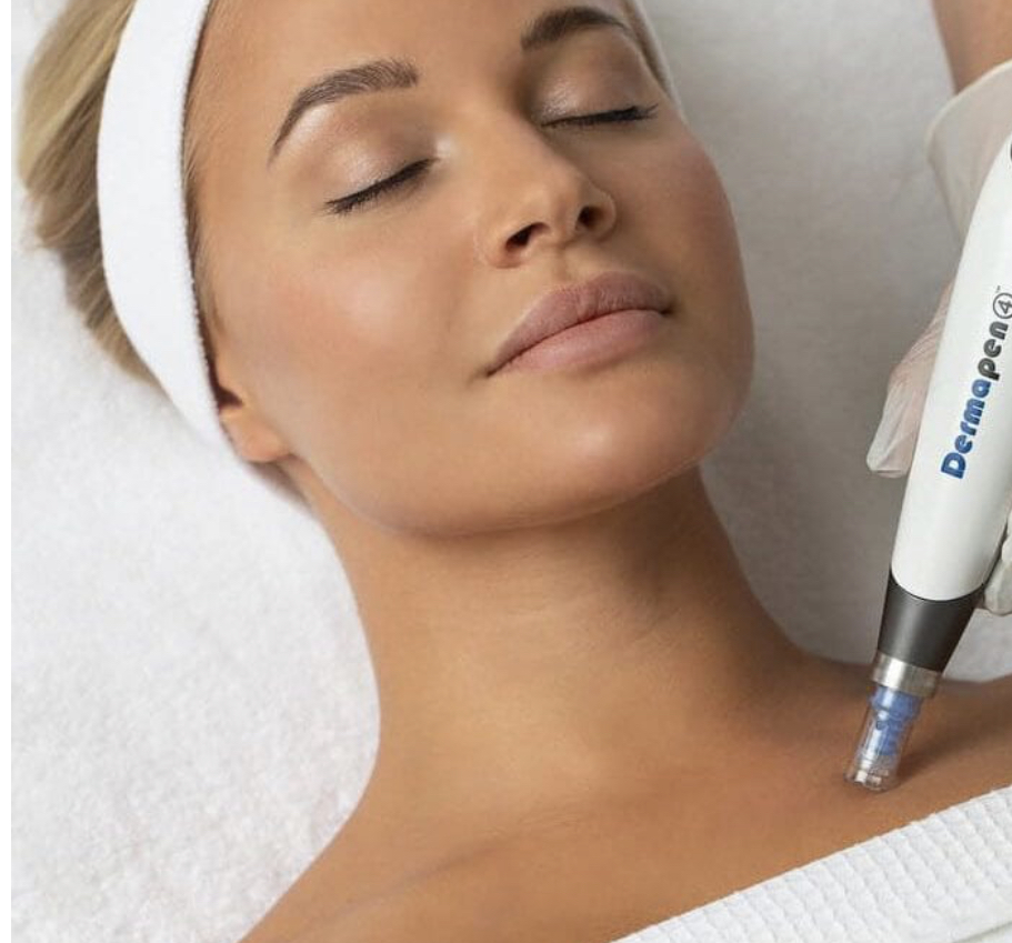 Microneedling/ Neck