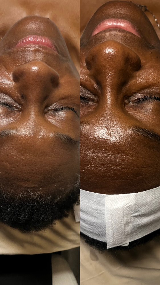 Anti Aging Facial ✨
