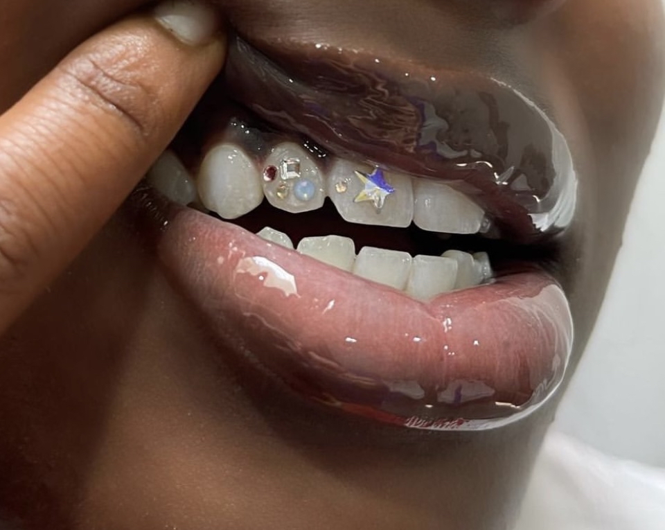 2 Tooth Gems