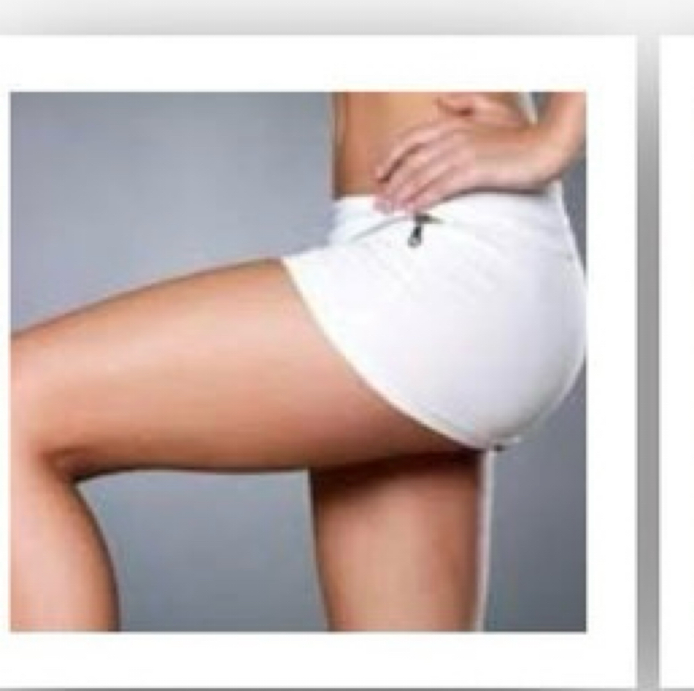 Inner Thigh Uneven Color Correction at MediGlow Spa in Spring, TX