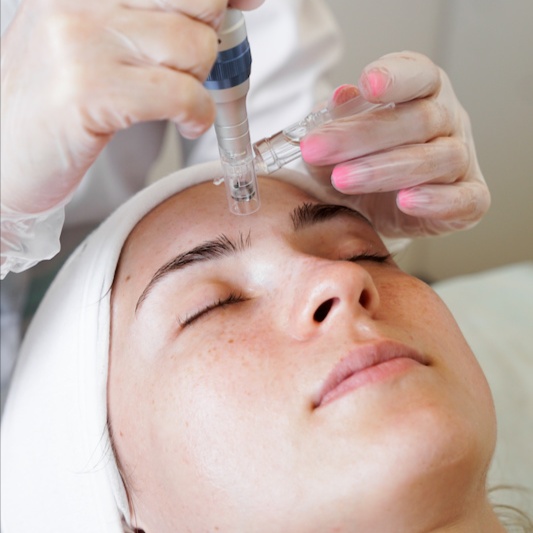 Smooth Canvas Mesotox Needle Facial at Zen Beauty in McAllen, TX