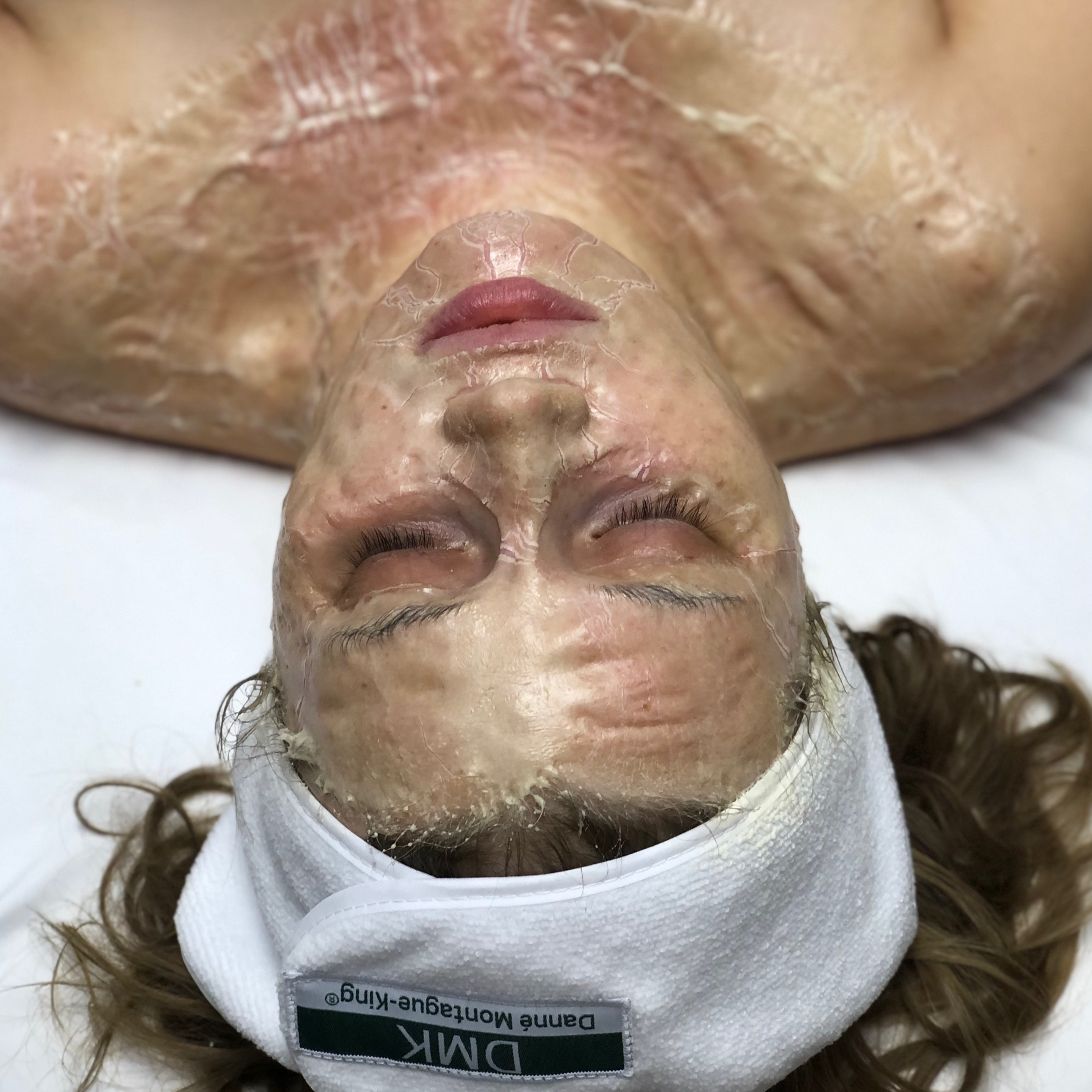 DMK Enzyme Therapy at The Skin Healer in Exeter, CA