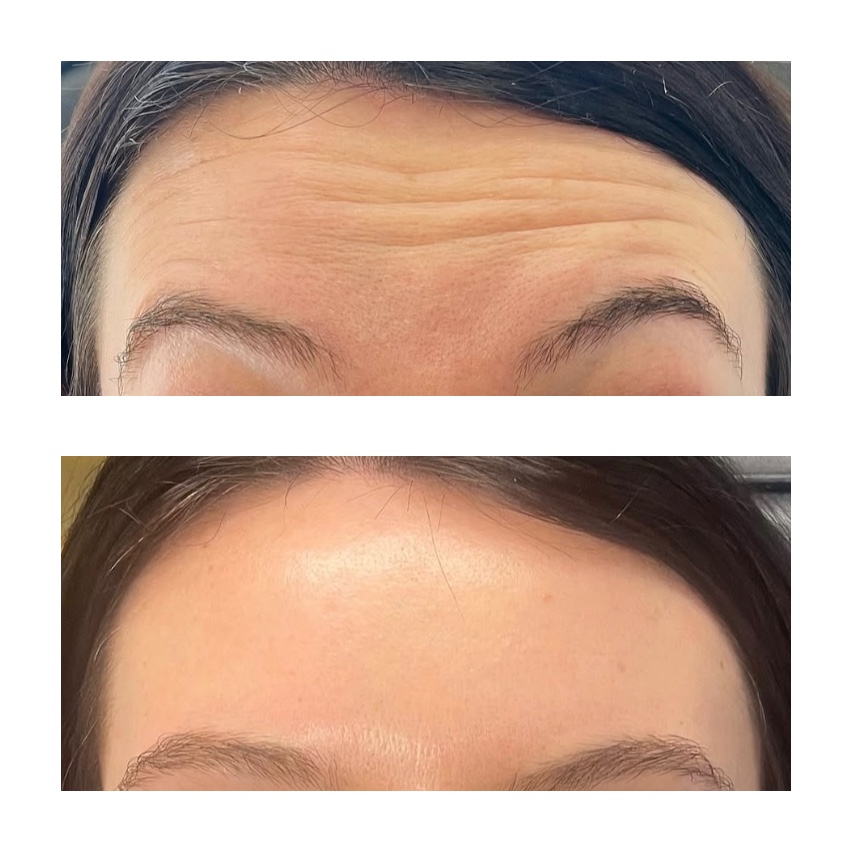 Tox Consult at Glowtox Haus in San Antonio, TX