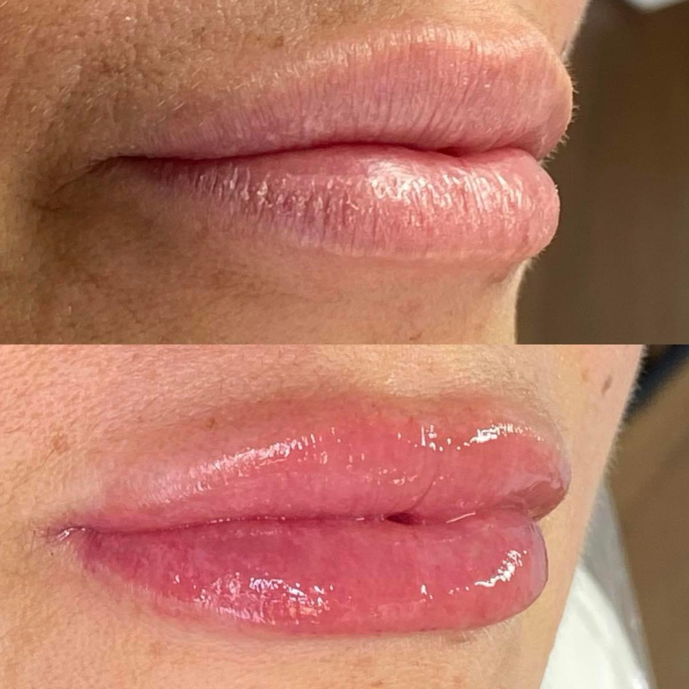 Lip Yearly Color Boost