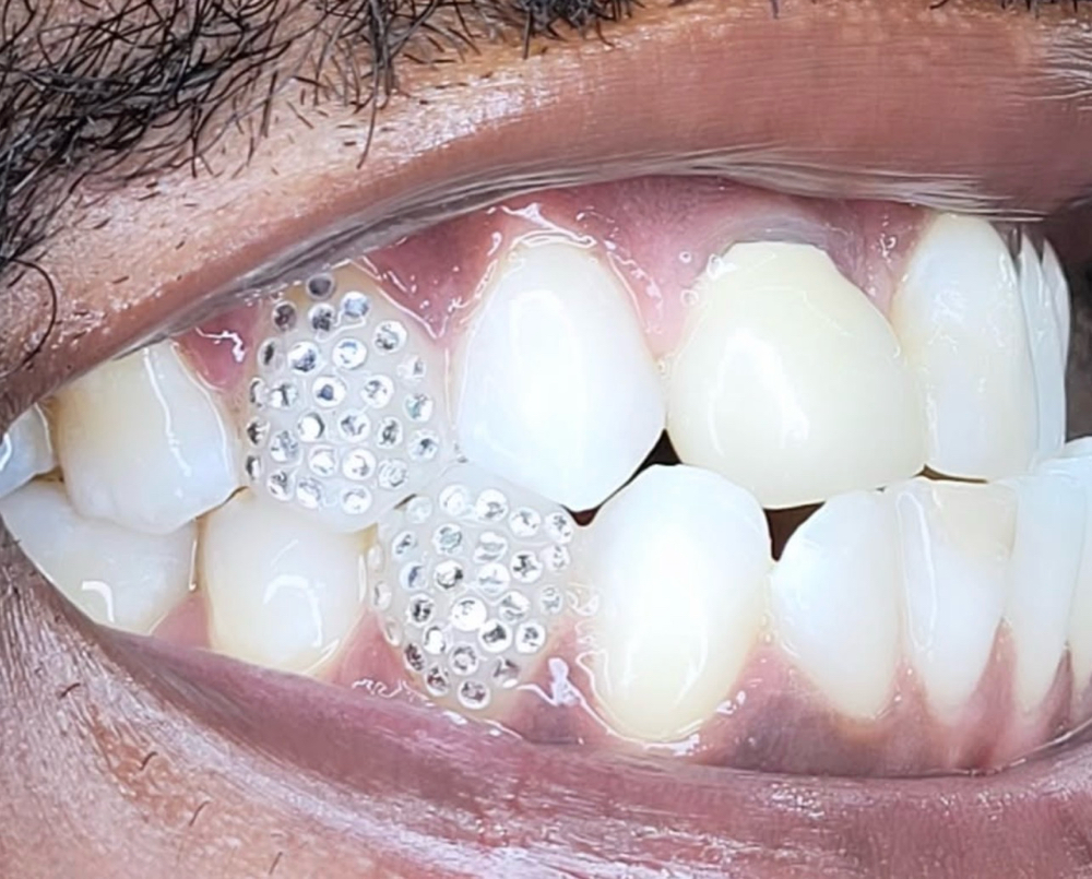 ✨💎Disco Ball at 💎Kat’s Tooth Gems💎 in Martinsburg, WV