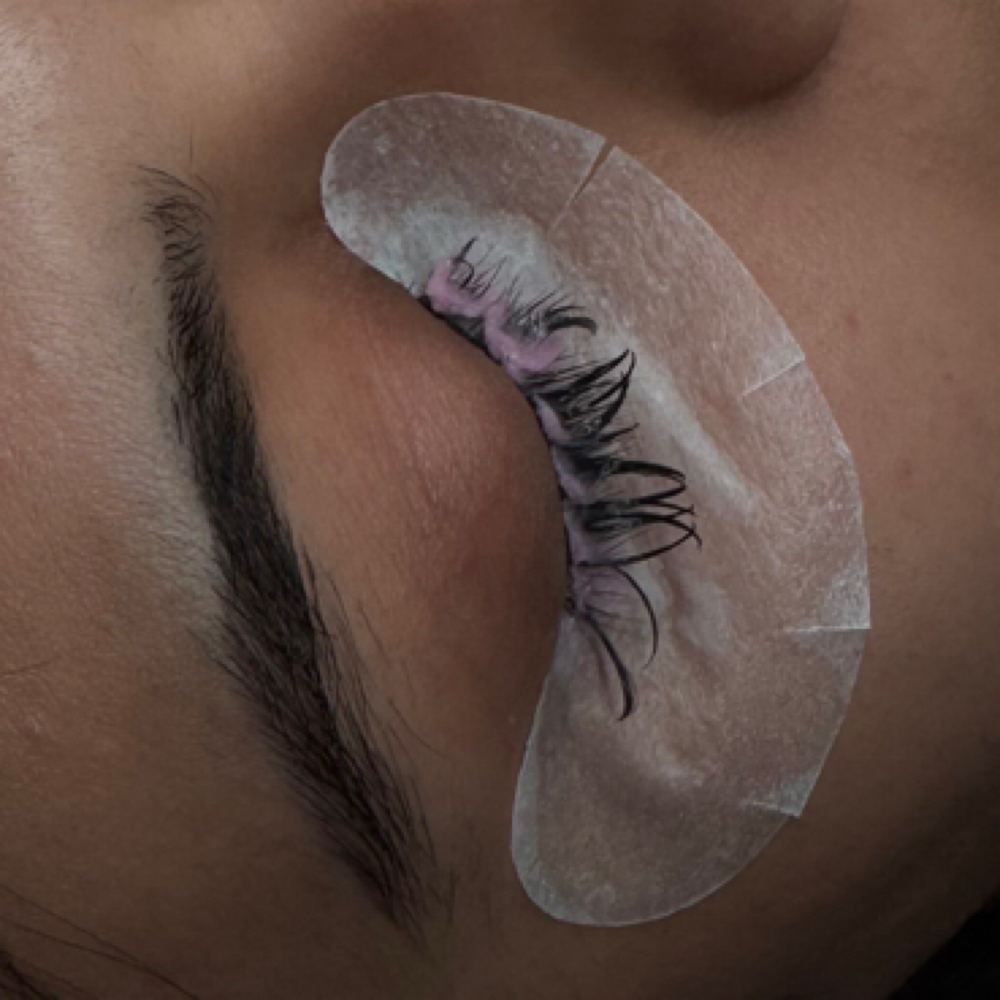 Removal at J’s Beauty Lab in Anahiem, CA