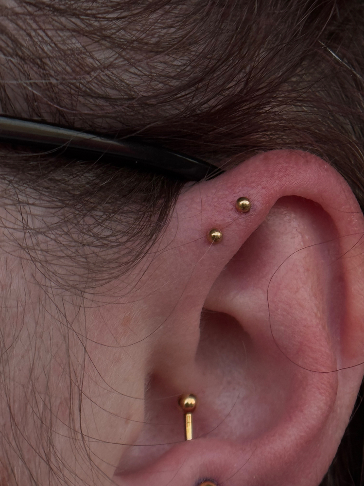 Forward Helix