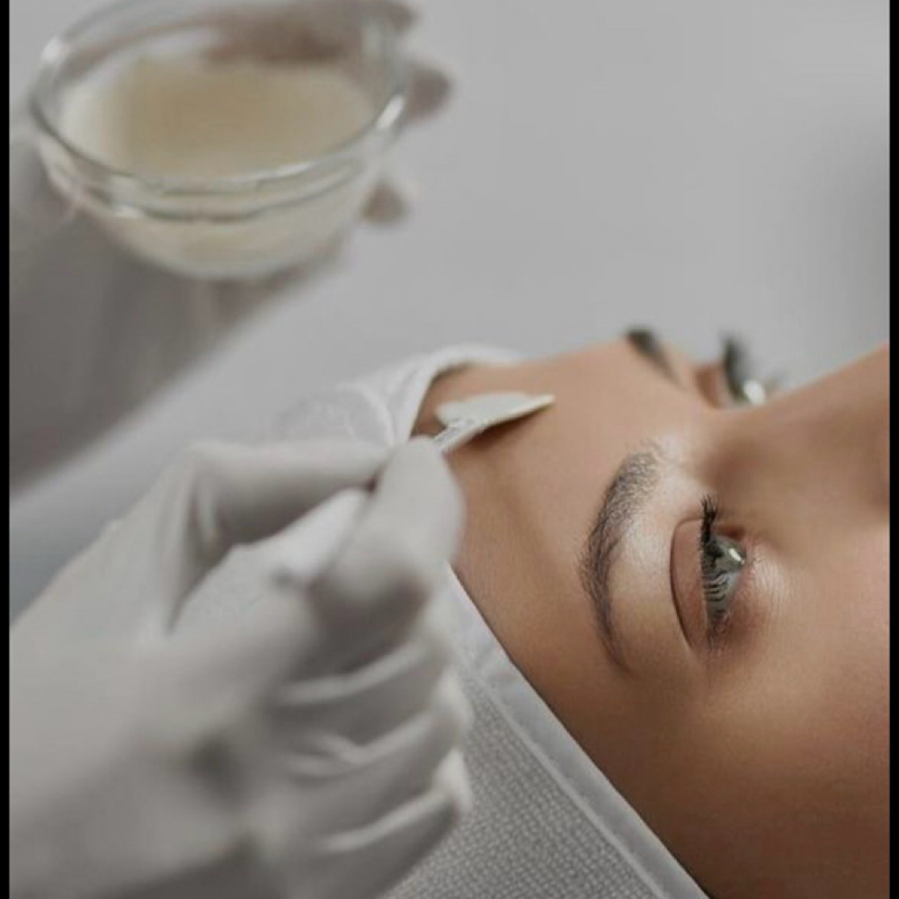 Chemical Peel at Beloved Beauty Aesthetics in Bonne Terre, MO