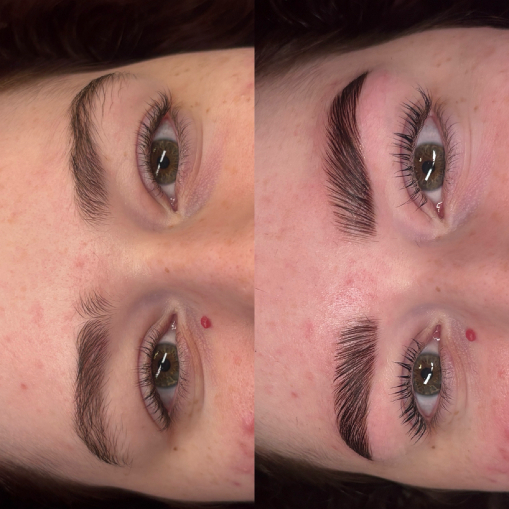Perfect eyes package at ZenGlow Esthetics in Gilbert, AZ