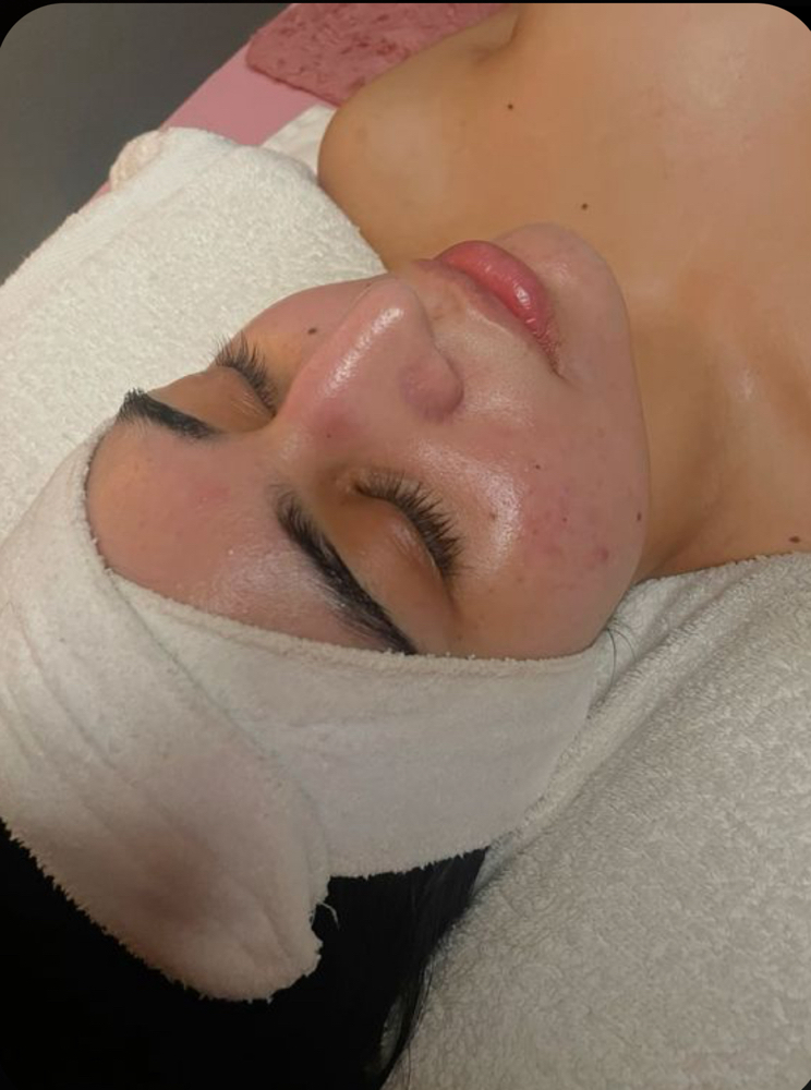 Teen Facial