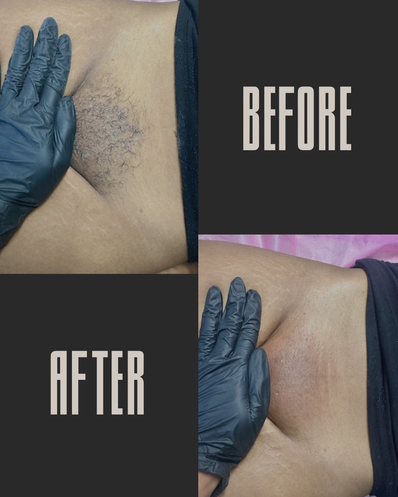Brazillian Wax at Karebear’s Beauty in Hiawatha, IA