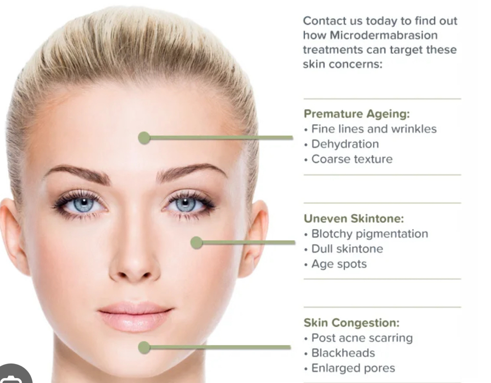 Microdermabrasion Only