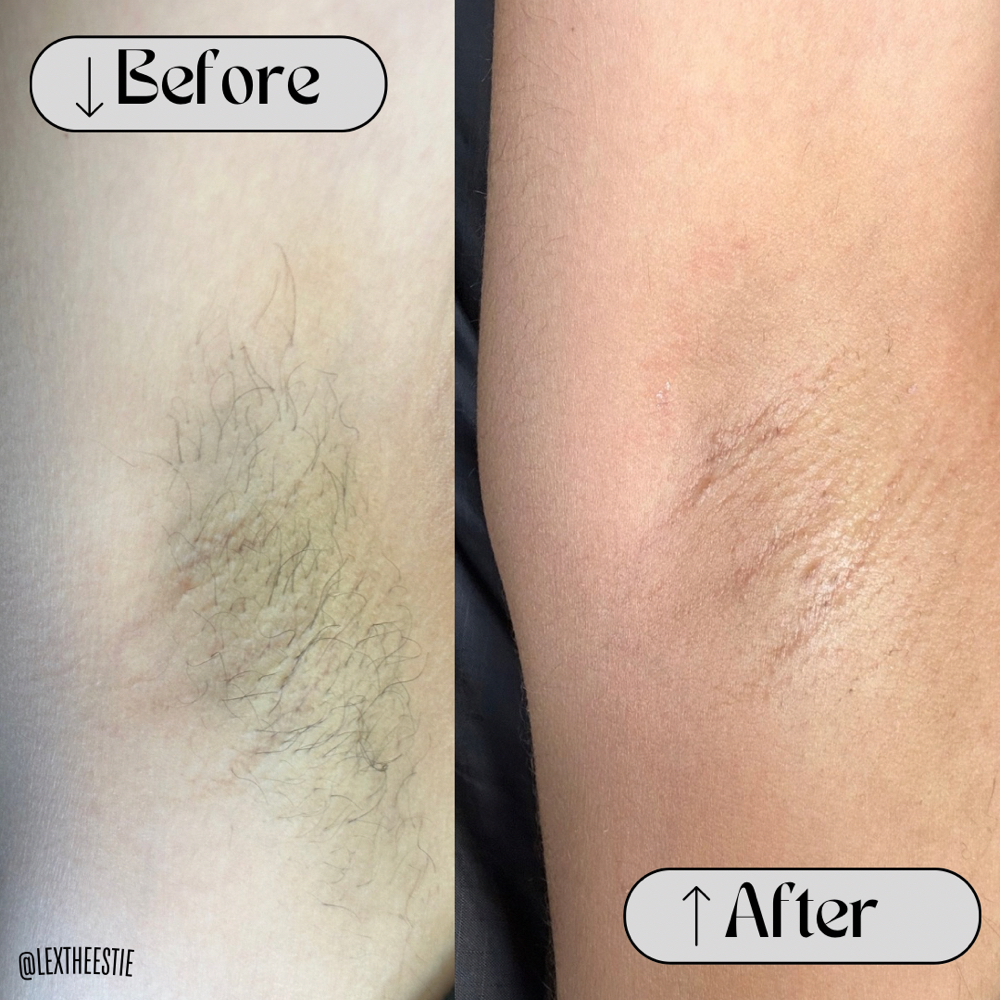 Under Arm at Love Beauty Lounge in Victorville, CA