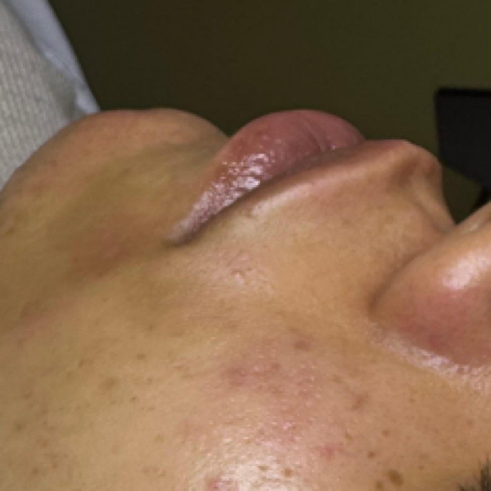 Upper Lip Wax at Danae Esthetics in Center Line, MI