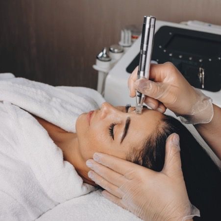 MICRODERMABRASION FACIAL