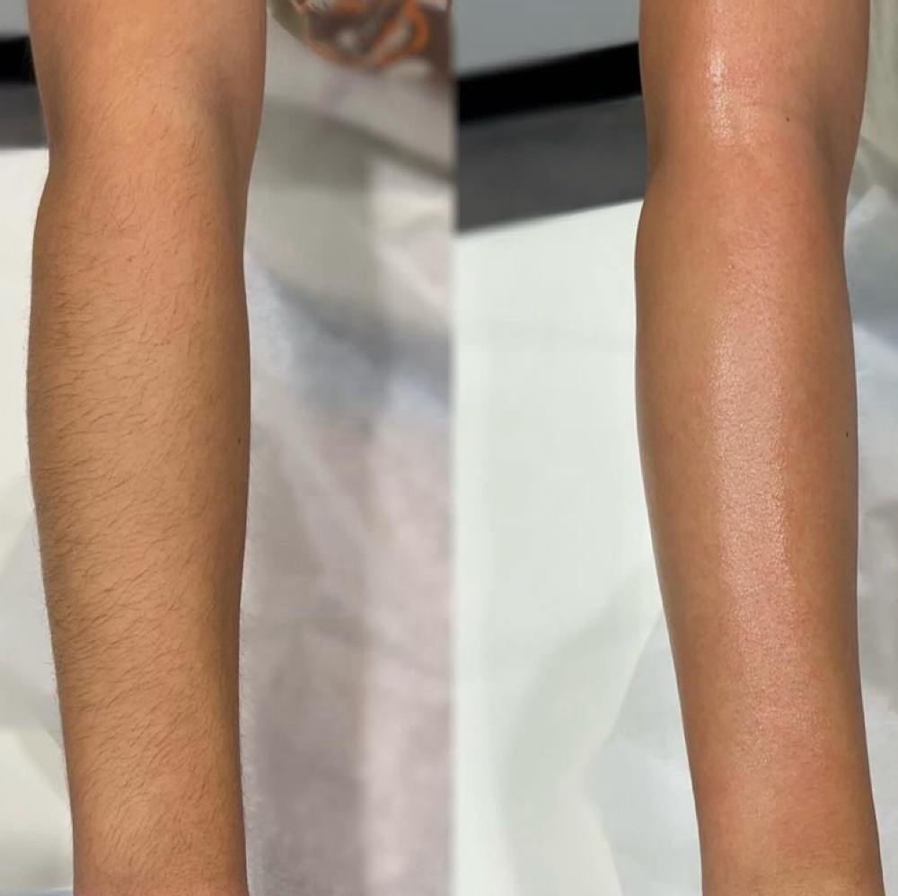 Full Arm Wax at Skin Lab by Ava Castelluzzo in Lapeer, MI