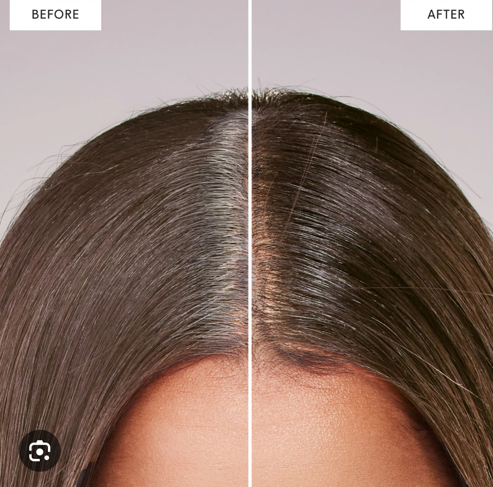 Root Touch Up