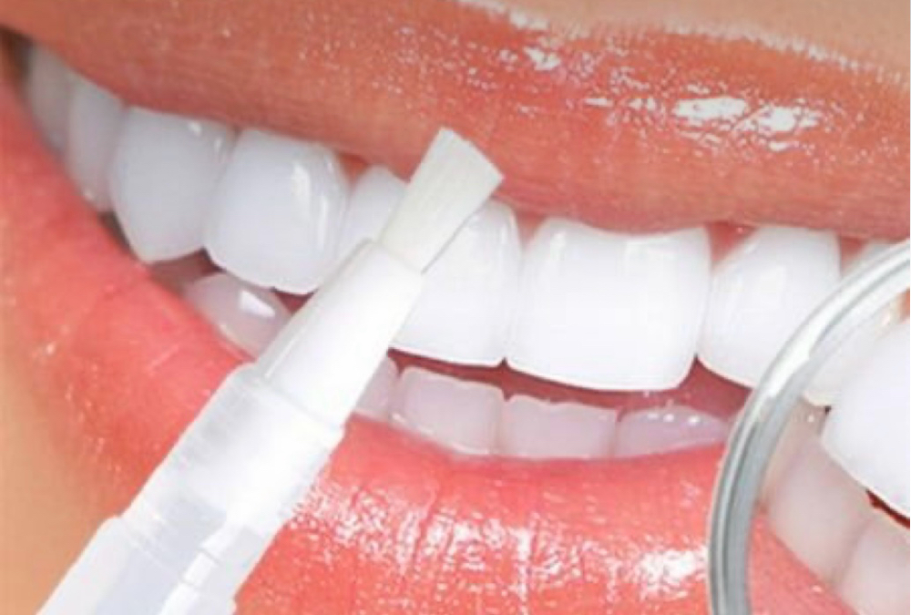 Teeth Whitening Strips