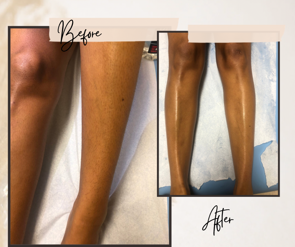 Lower Leg Wax