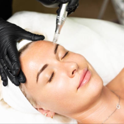 Microneedling at Maxará Aesthetics in Griffin, GA