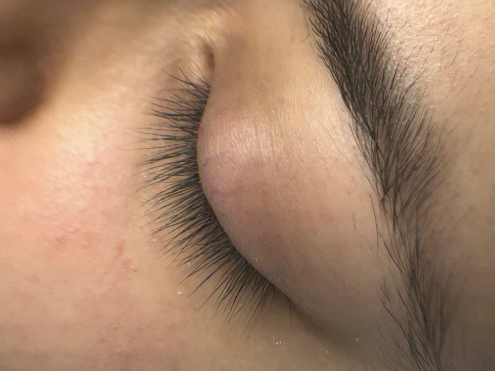 Eyelash Extension Removal