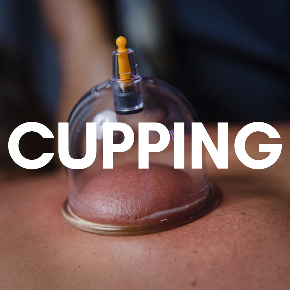 Cupping at Soothing Hands Massage in Flowood, MS