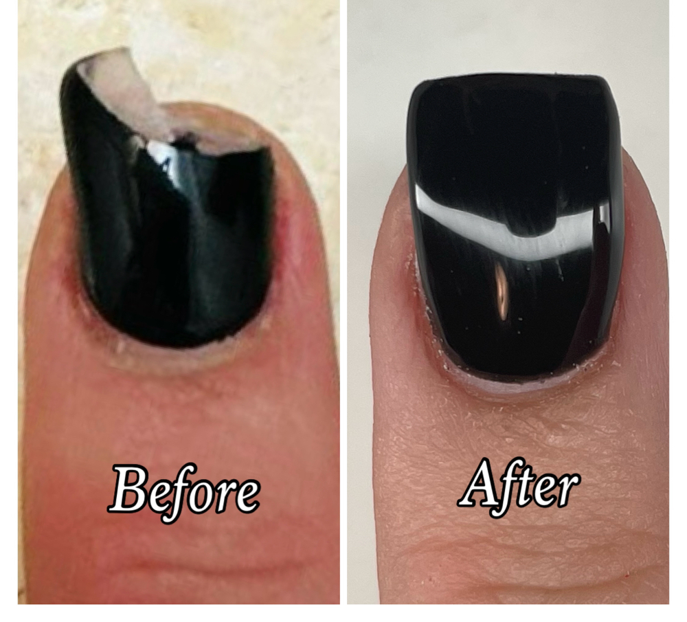 Nail fix