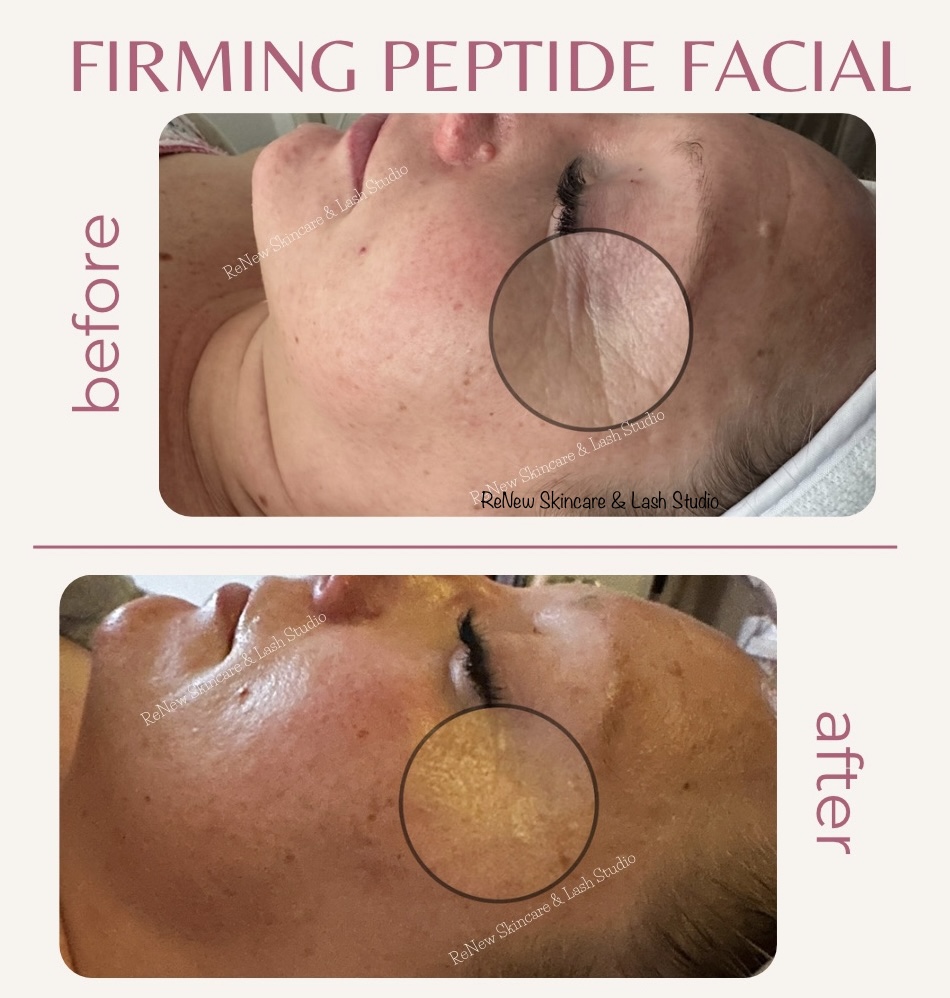 Anti-Aging RENEW Firming Peptide Facial