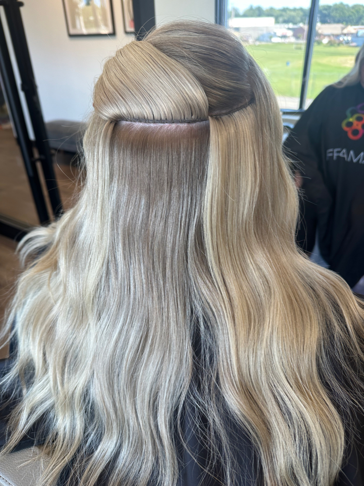 Invisible Bead Extensions Consult
