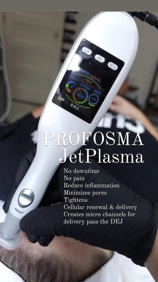 Jet Plasma 2 Areas