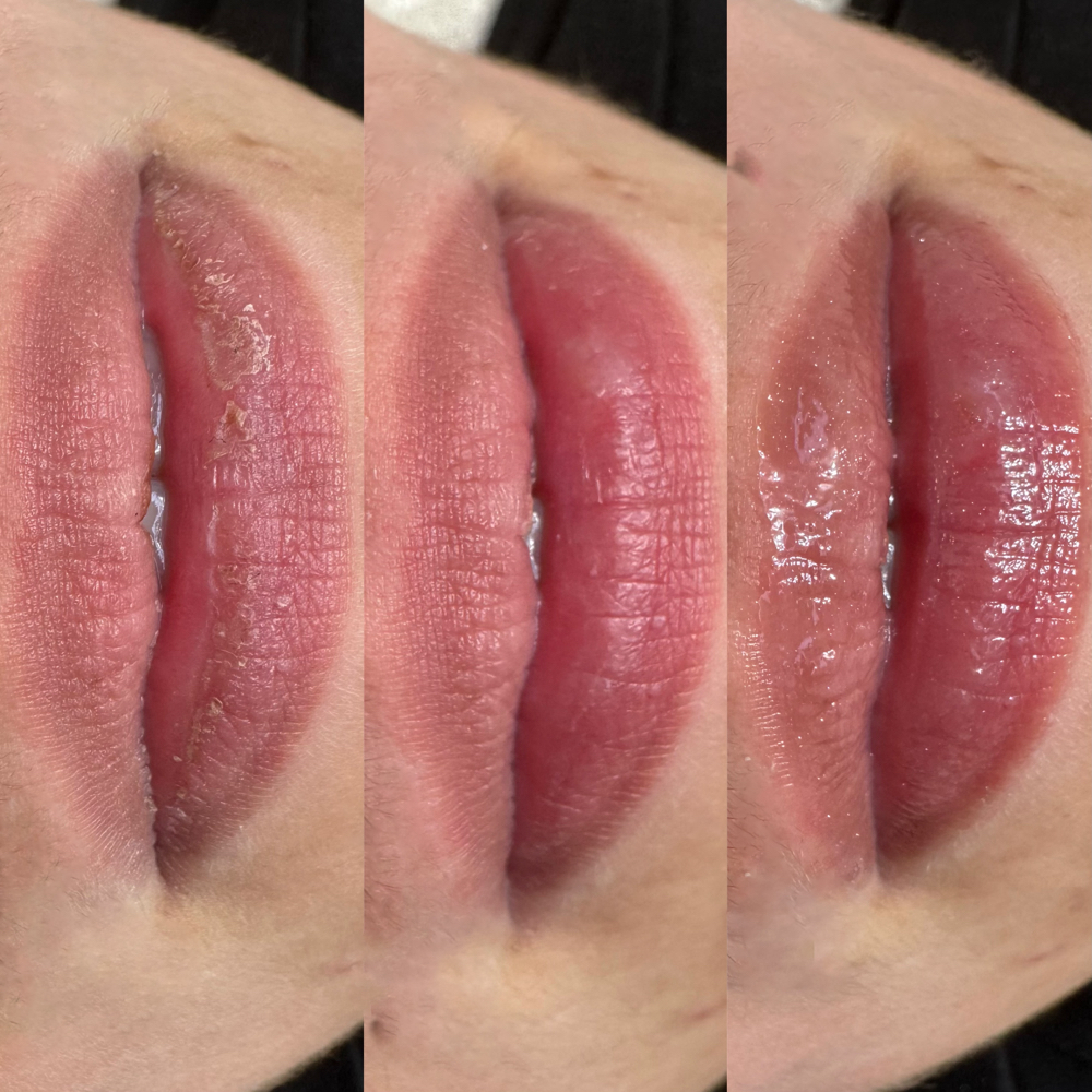 Nutrigloss - Lips Treatment