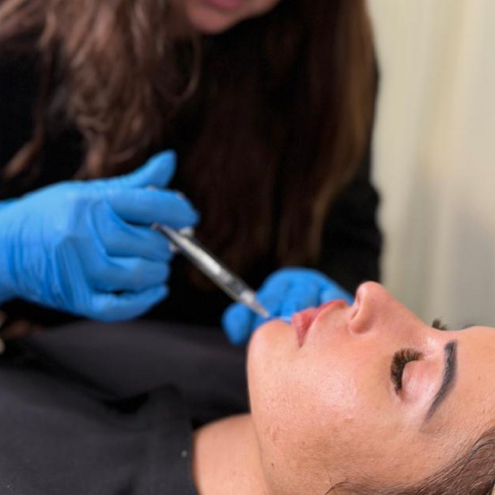 Botox/Xeomin/Jeuveau Consult at U•Glow by Laura Mesa in Tampa, FL