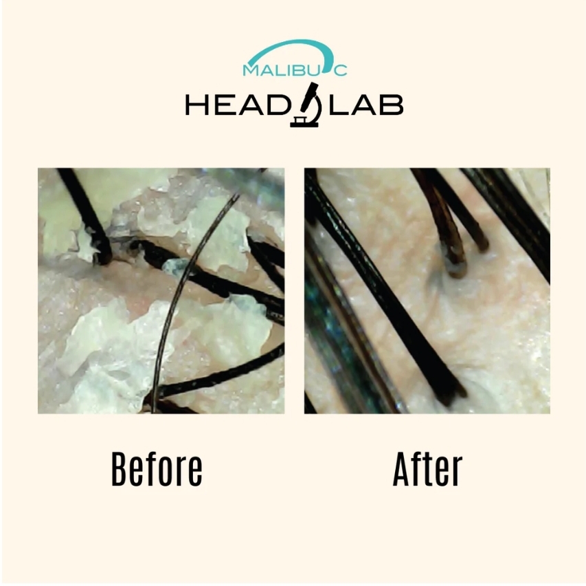 Hot Oil Treatment( With Steamer)