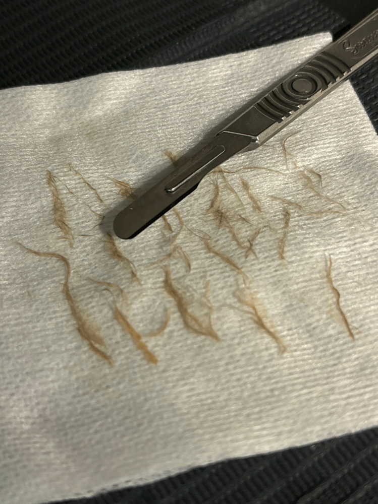 Dermaplane Add On