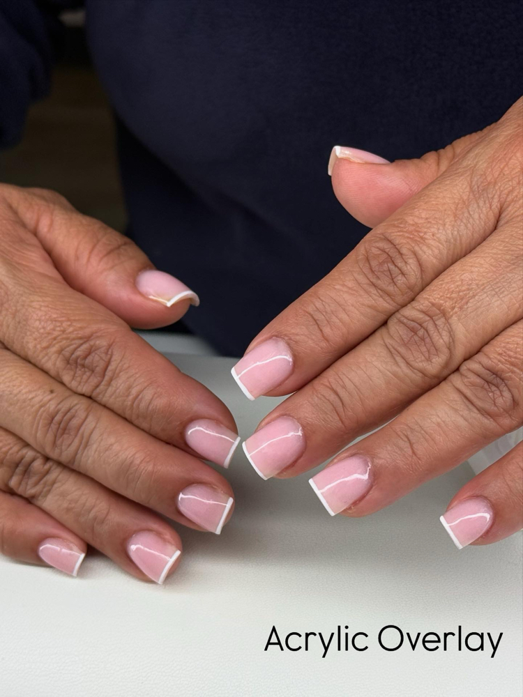 Acrylic Overlay