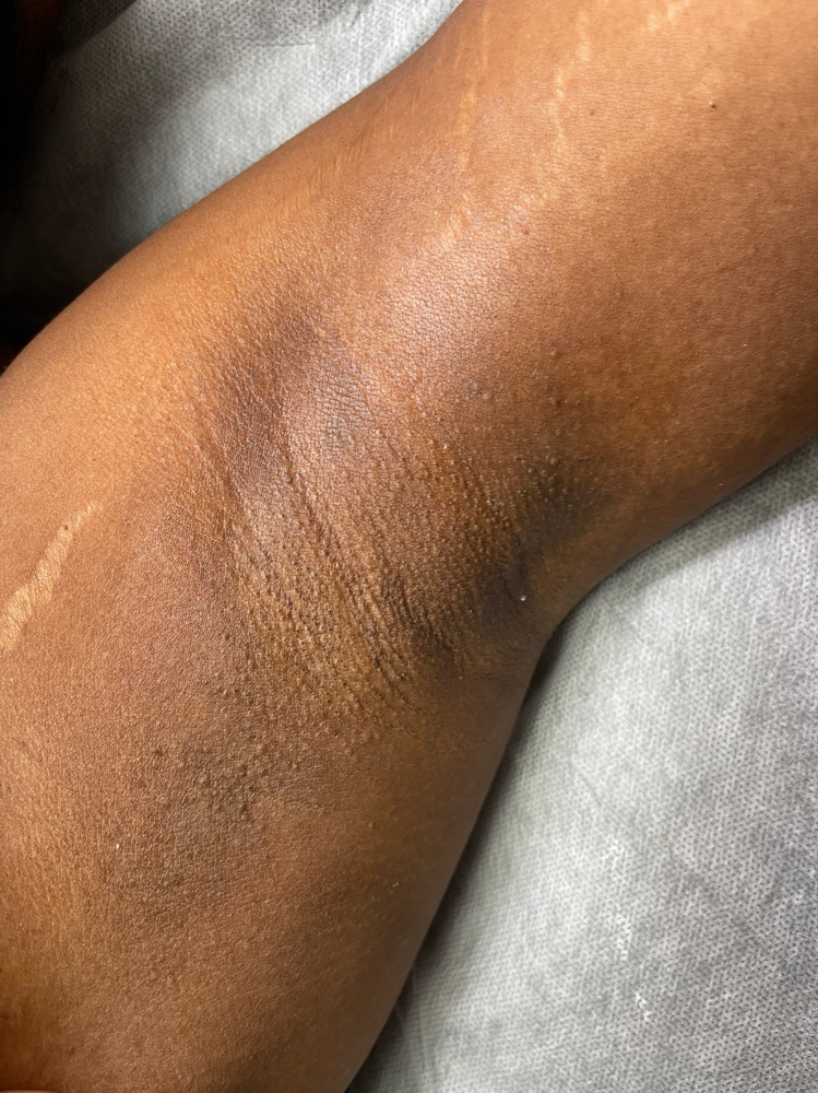 Underarm Wax