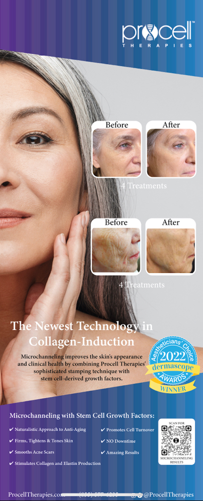 Procell Microneedling