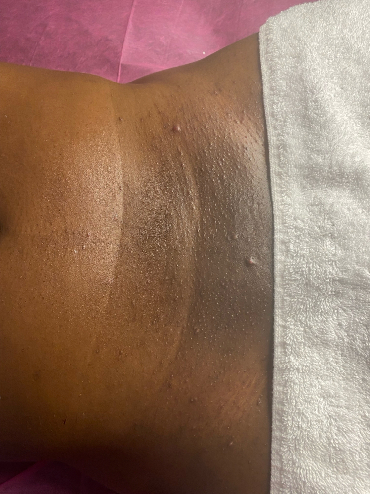 Will’s wax (Male brazilian at Eximius Bella in Garner, NC