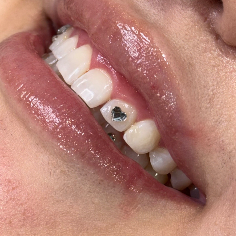 Shaped Tooth Gem at JCR Piercings in Waukegan, IL