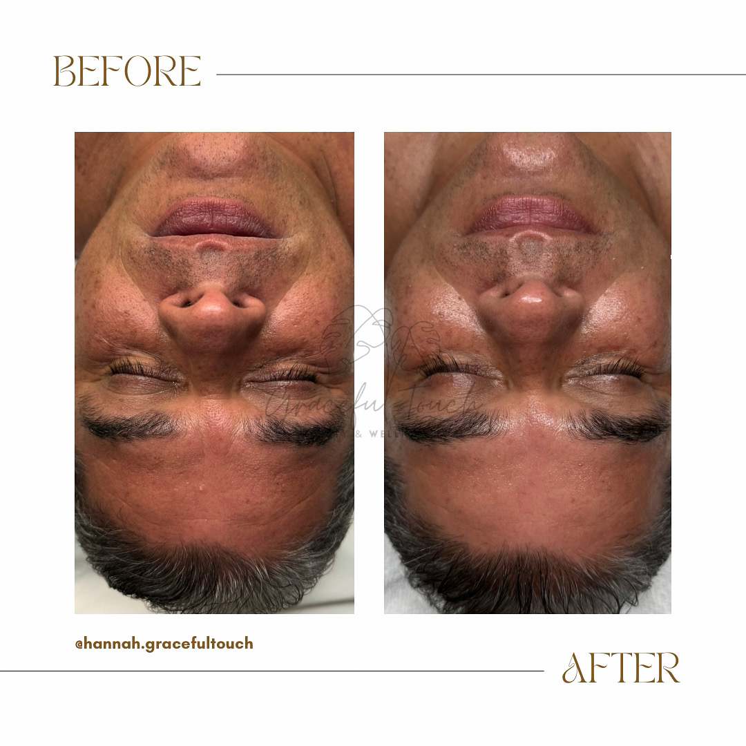 Graceful HydraRestore Facial