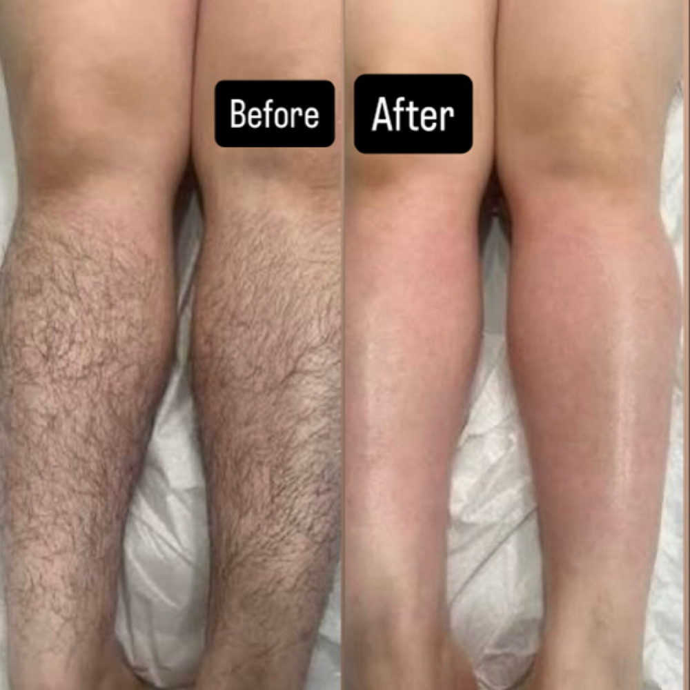 Full Leg Wax at Queensmade Esthetics in Wilmington, NC